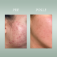 PURE SKIN SOLUTION Gel za čišćenje s niacinamidom PURE SKIN SOLUTION Gel za čišćenje s niacinamidom