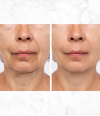 NEXT GENERATION RETINOL SHOT