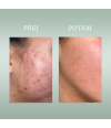 PURE SKIN SOLUTION Ultra lahka vlažilna krema 