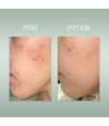 PURE SKIN SOLUTION Ultra lahka vlažilna krema 