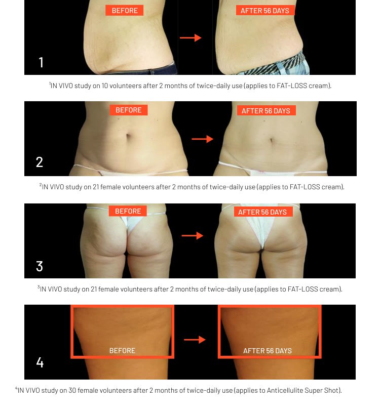 ANTI-CELLULITE