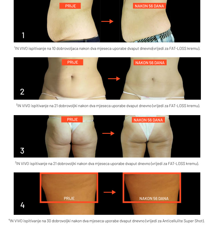 ANTI-CELLULITE