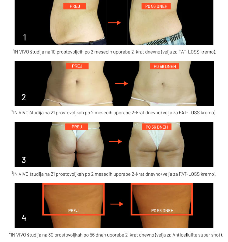 ANTI-CELLULITE